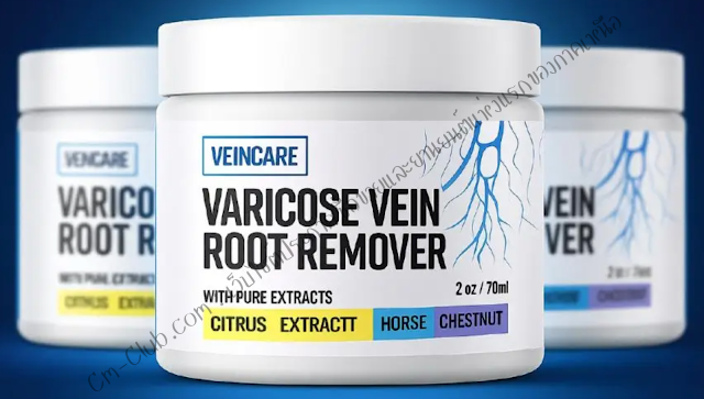 Veincare%20Varicose%20Vein%20Root%20Remover.png