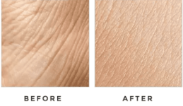 Derma%20Glo%20Skin1.png?part=0.png Derma%20Glo%20Skin1.png?part=0.png